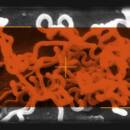 Image of Syphilis a Bacterium called Treponema Pallidum